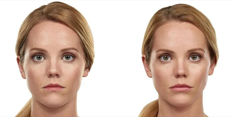 Before & After