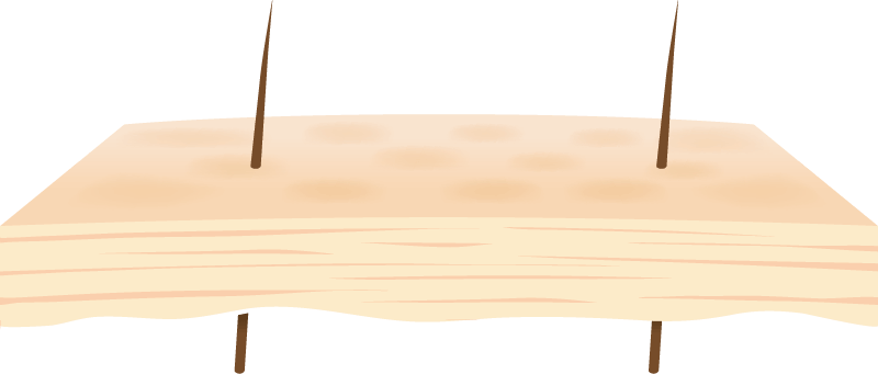 Epidermis