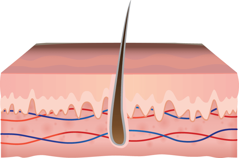 Dermis