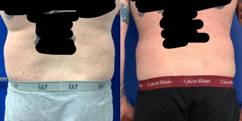 Before & After