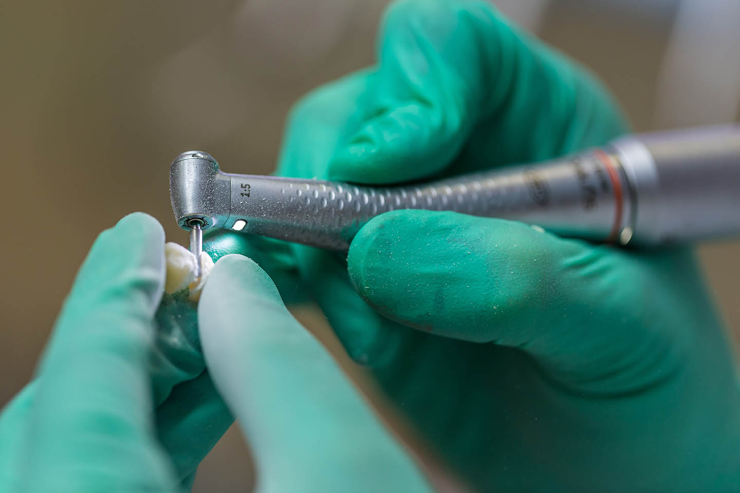 Cosmetic Dentists in Modesto Downey Park Family Dentistry