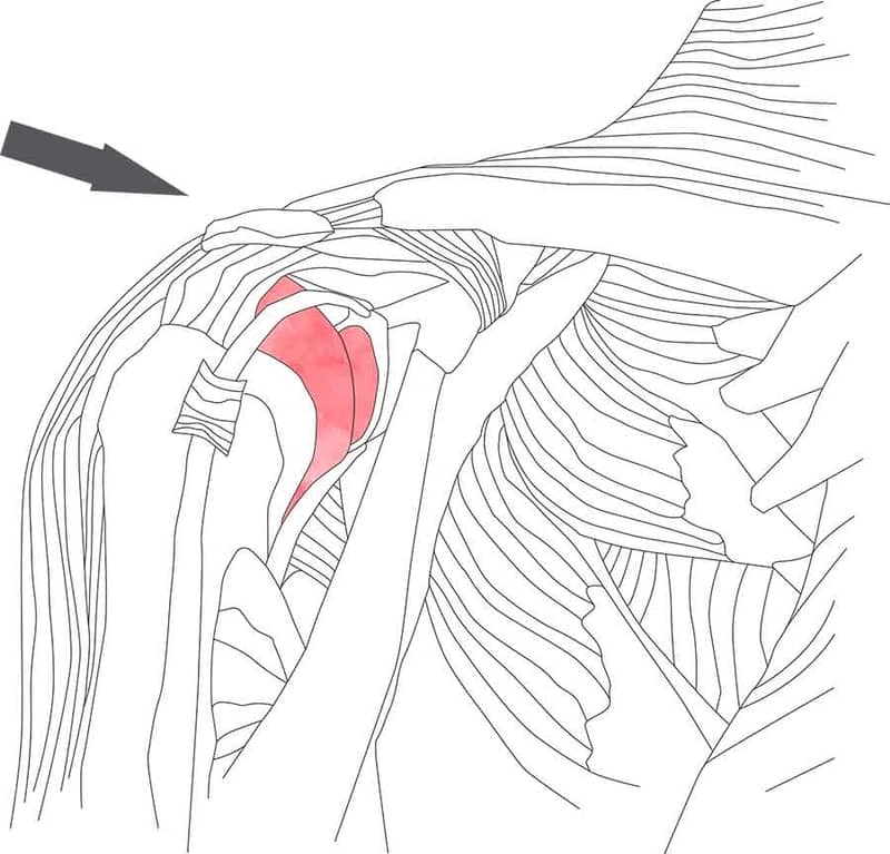 Shoulder Injuries & Conditions - Shoulder Clinic