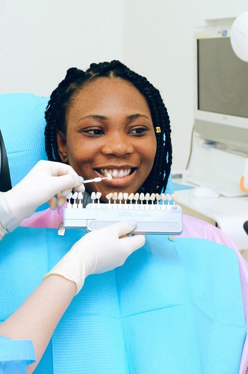 Q: How Long Do Veneers Last? | Dental Image Therapy Centres