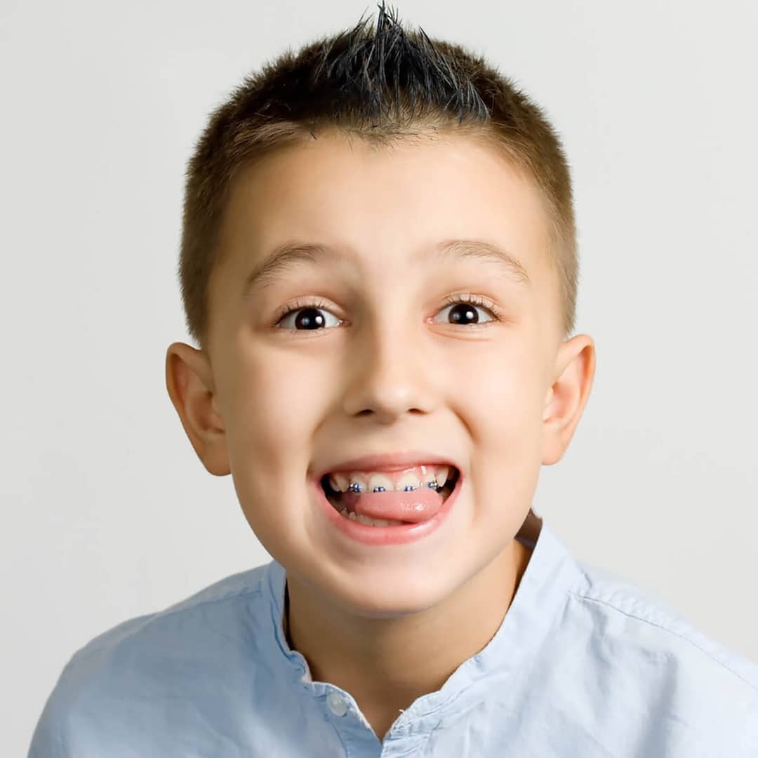 Aligned Orthodontics Salford Orthodontics Manchester Orthodontist