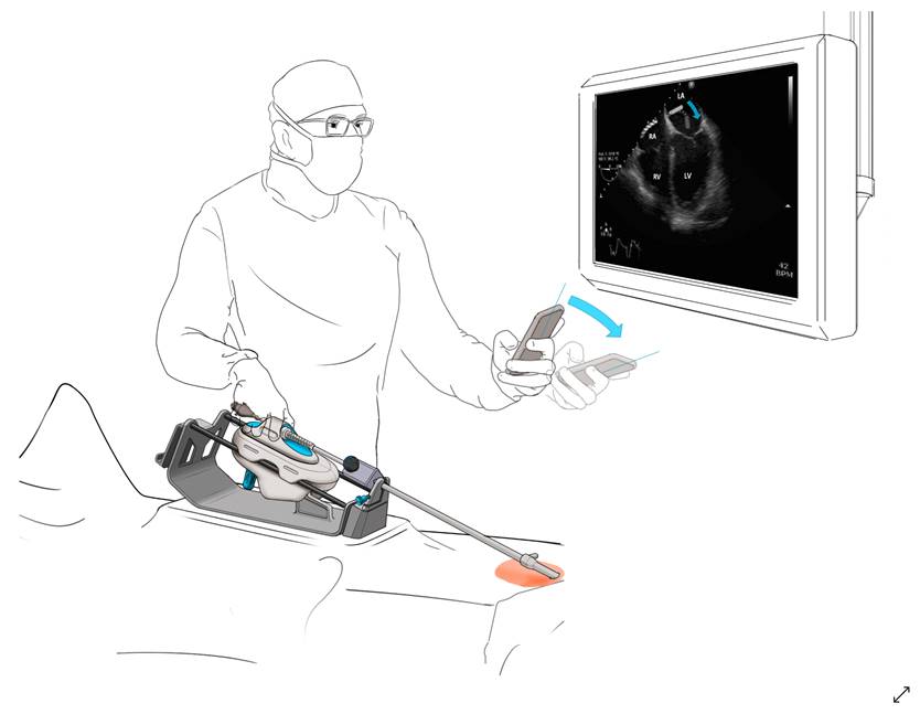 Project Moray Medical Device Demo Illustration