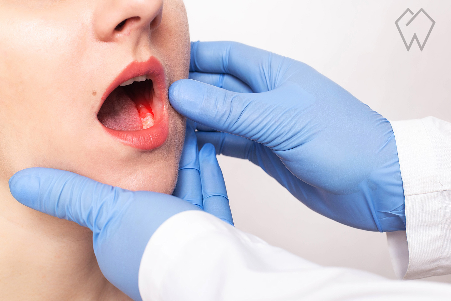 Cleveland TMJ Therapy Cleveland