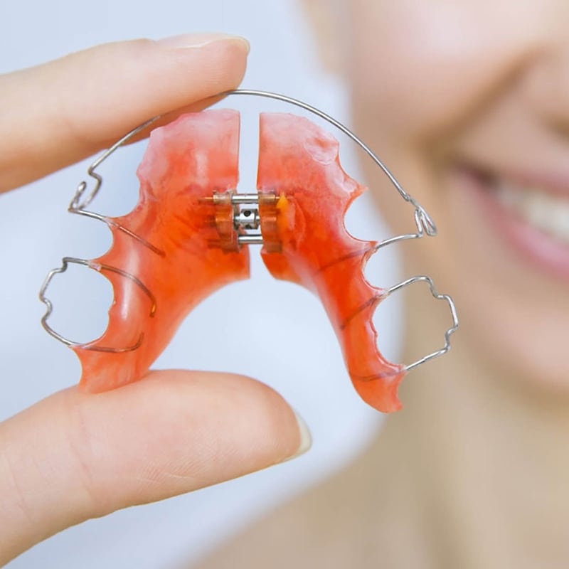 Retainers Orthodontist In Edinburgh NHS & Clear Braces