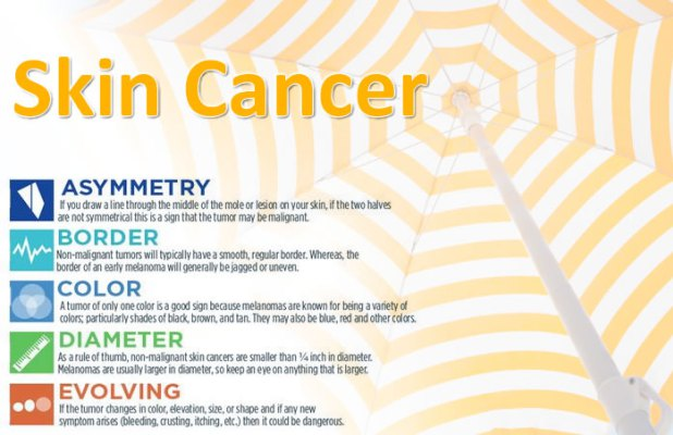 Skin Cancer Image