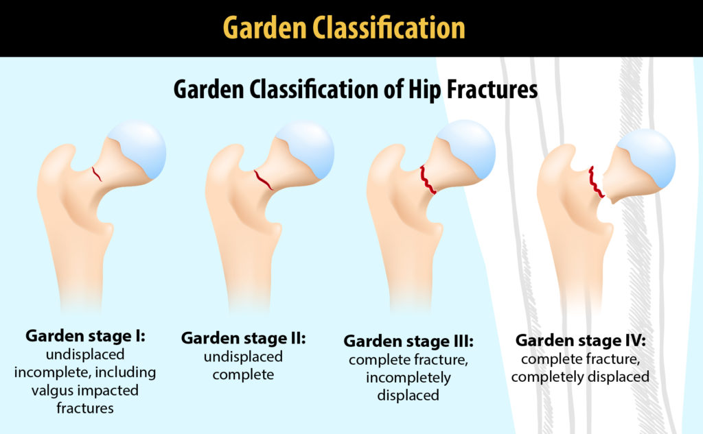 Garden classification