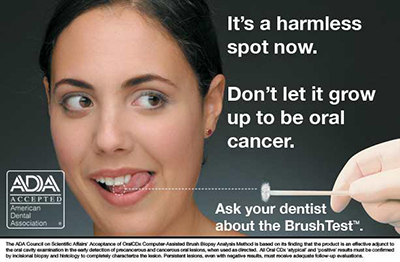 Oral Cancers