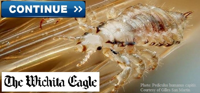 Wichita Eagle Interviews LiceDoctors Owner Karen Sokoloff About Super Lice