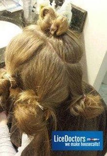 get rid of head lice treatment for long thick hair successful