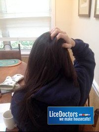 Does Everyone Itch From Head Lice