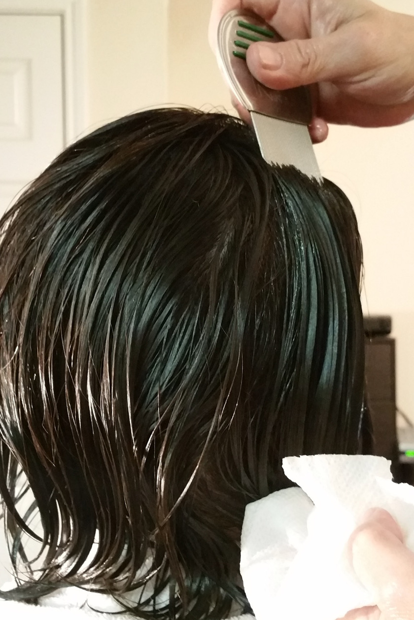 Head Lice Story in Pictures LiceDoctors