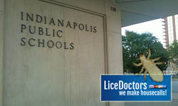 Indianapolis_school_lice_policy