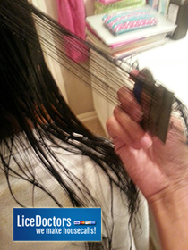 Combing out lice during treatment