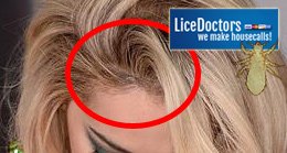 Woman with wig - LiceDoctors
