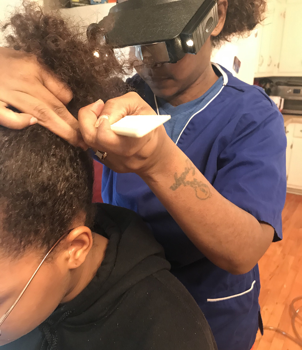 Lice Treatment in Atlanta, Georgia