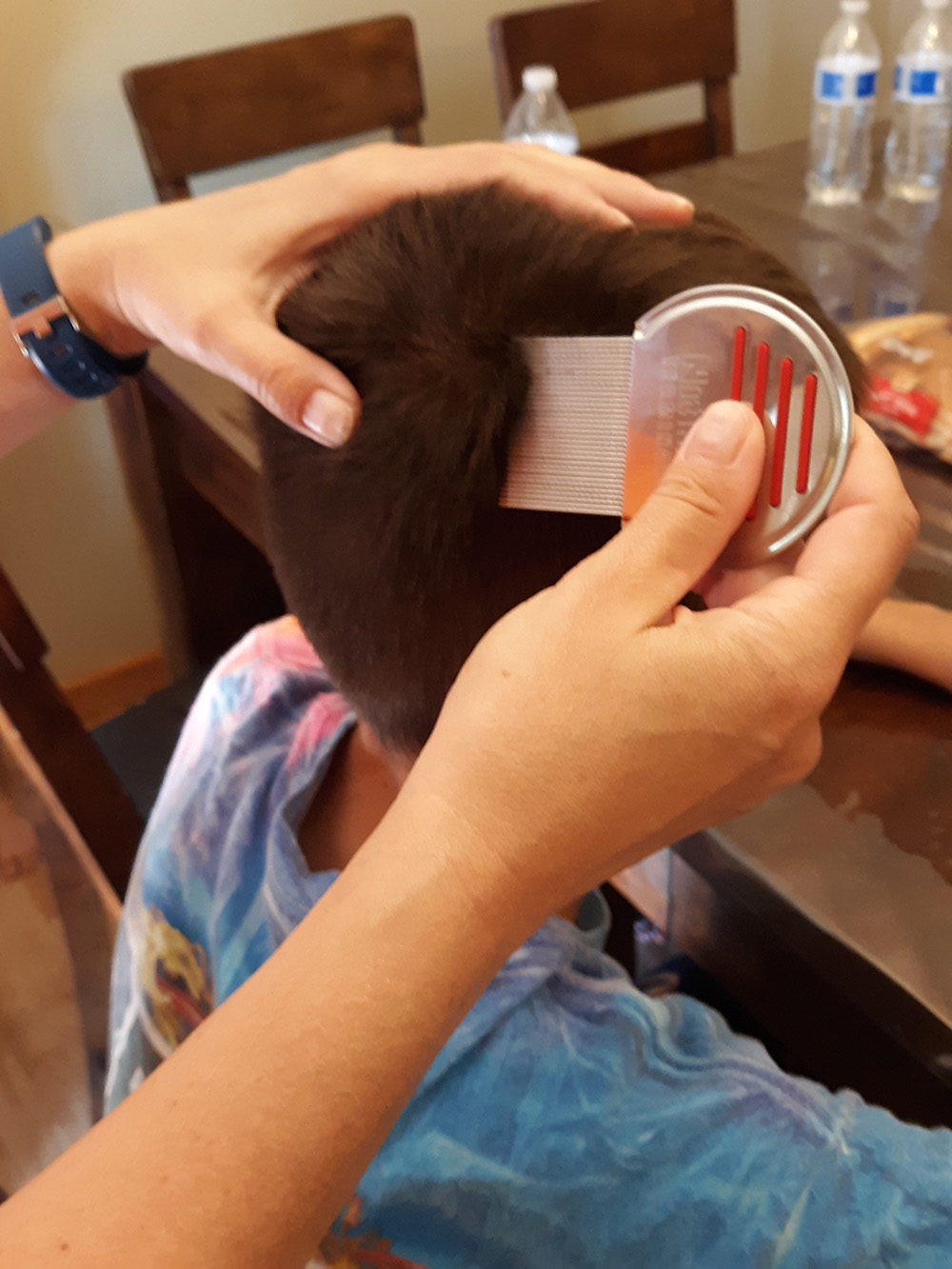 Lice Treatment in Bartlett and Millington, TN