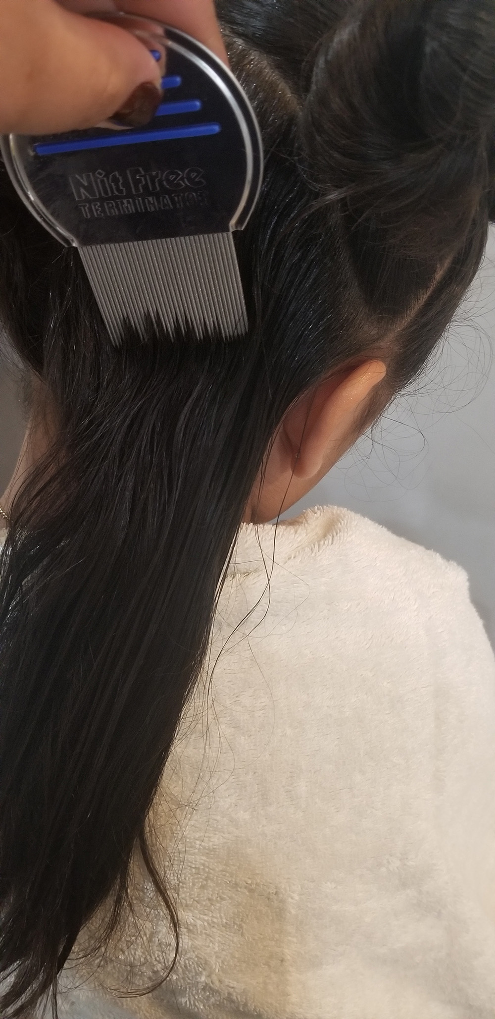 Lice Treatment in Cambridge and Brookline, MA