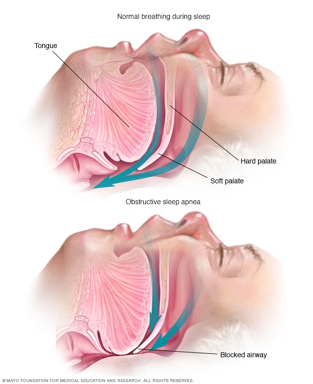 Soft tissues of the throat