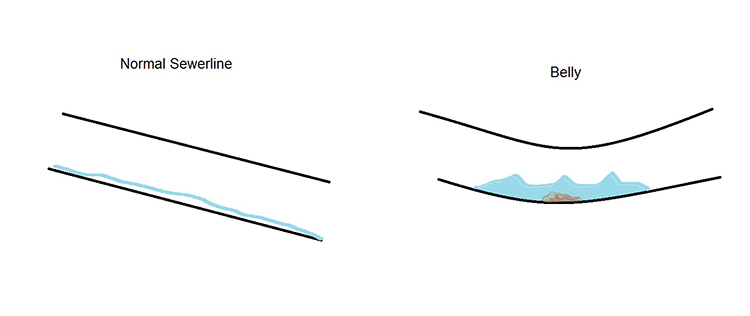 Description of normal sewerline vs. belly