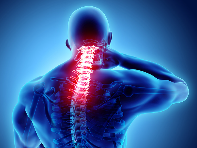 Is Neck Fusion Surgery Necessary?