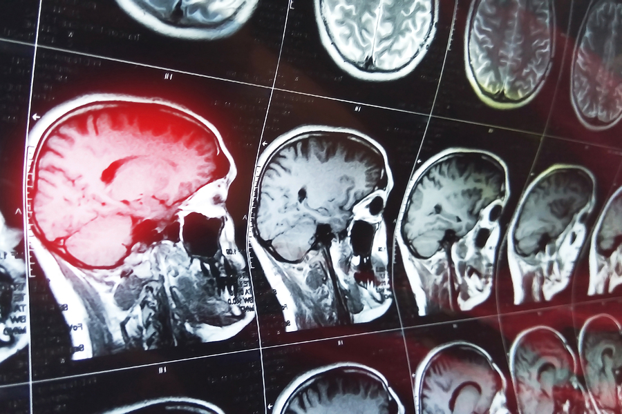 Inner Imaging Testing is Suspended Until Further Notice