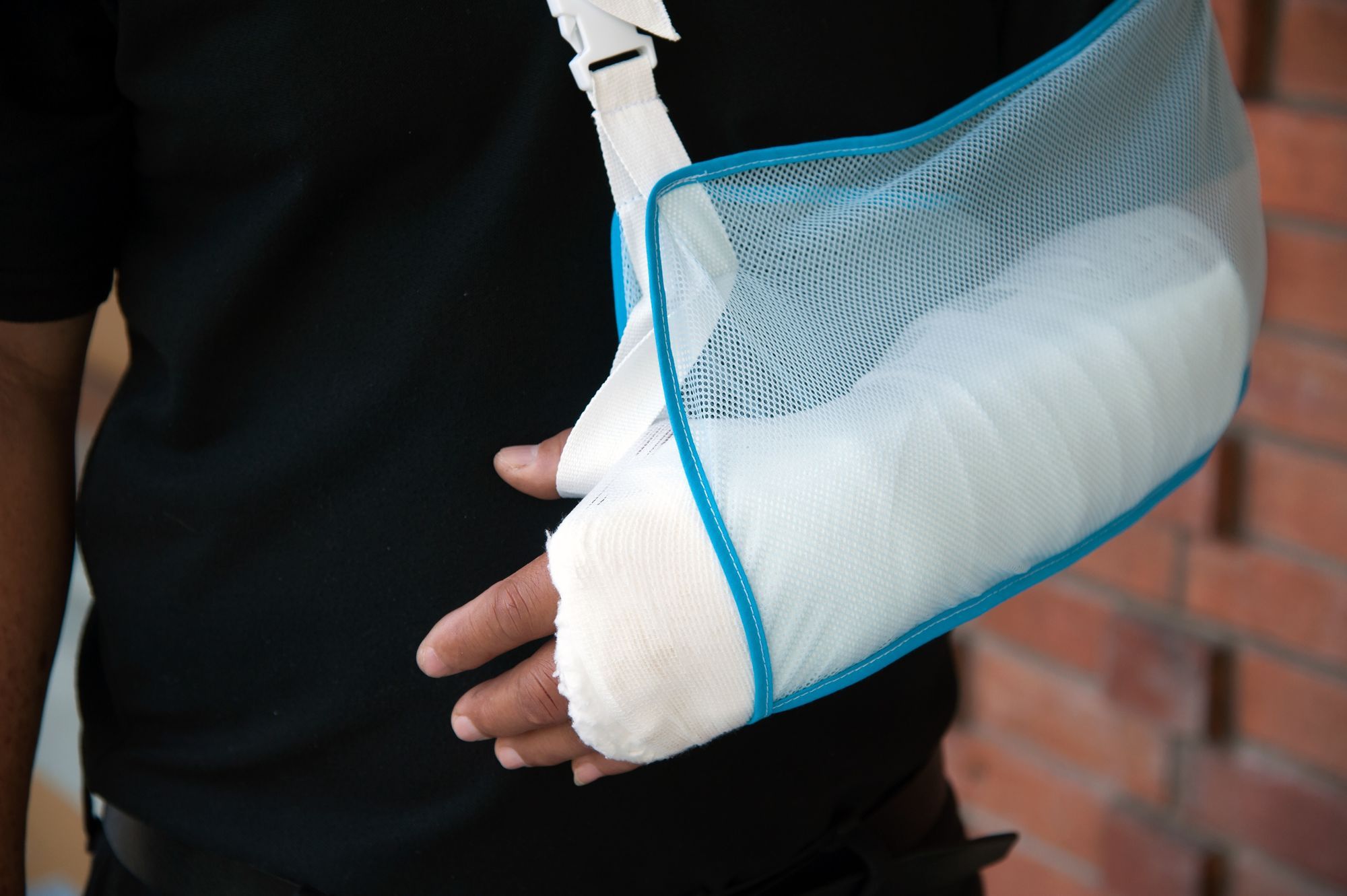 Complete Guide to Common Wrist Fractures
