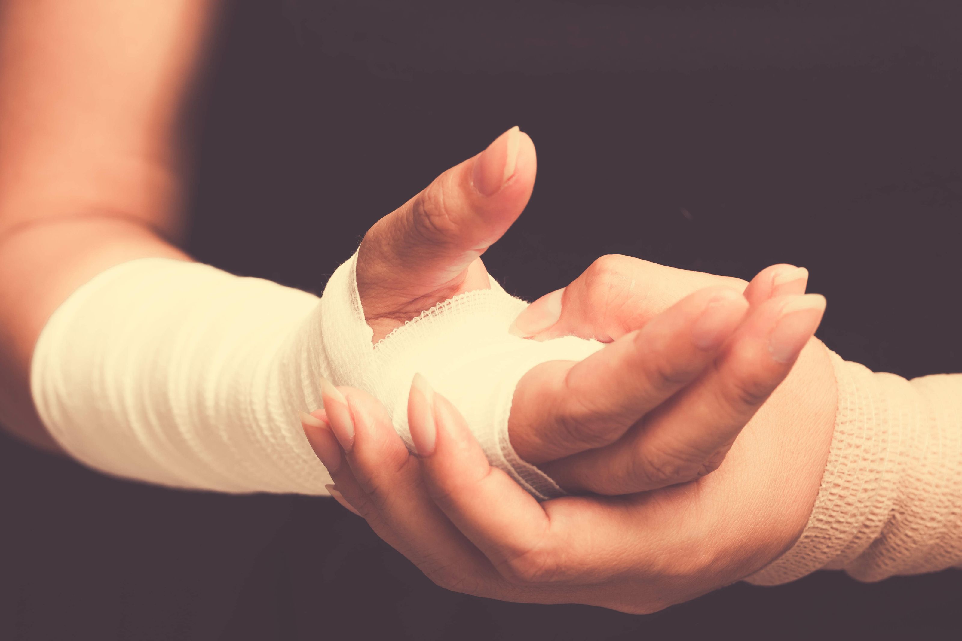 Types of Short Arm Casts Which One Is Right for You?