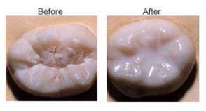 Sealant - before and after