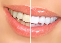 Teeth-