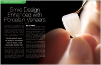 Getting fitted for Veneers - Dear Doctor Magazine