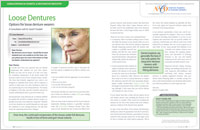 Loose Dentures