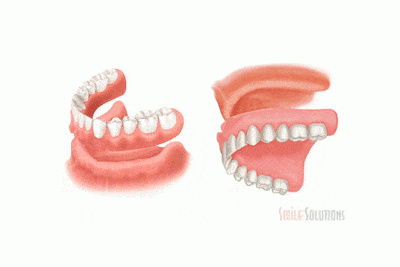 Dentures