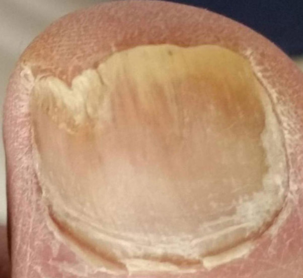 Rugby Podiatry The Lacuna Method