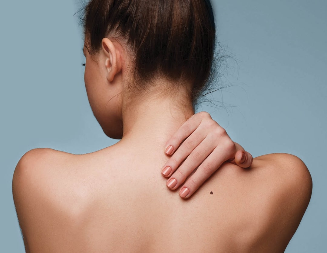 Skin Cancer Bay Plastic Surgery Adam Bialostocki