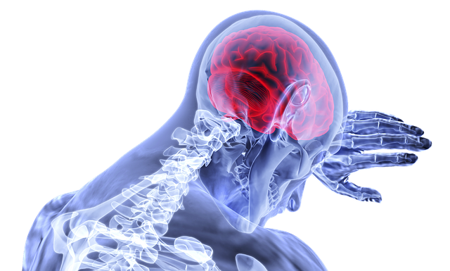 CBD et épilepsie