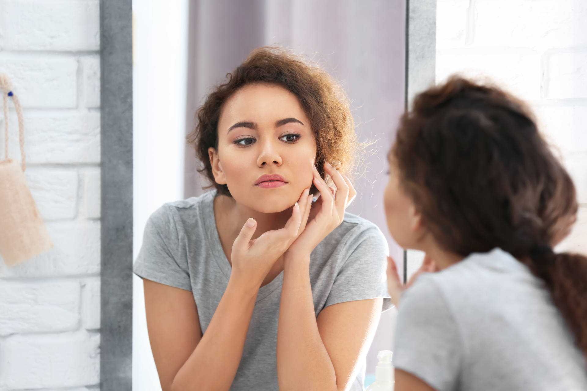 What Causes Acne?