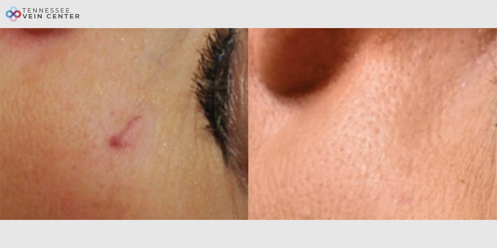 Scars 1003