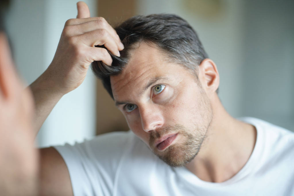 Thinning Hair