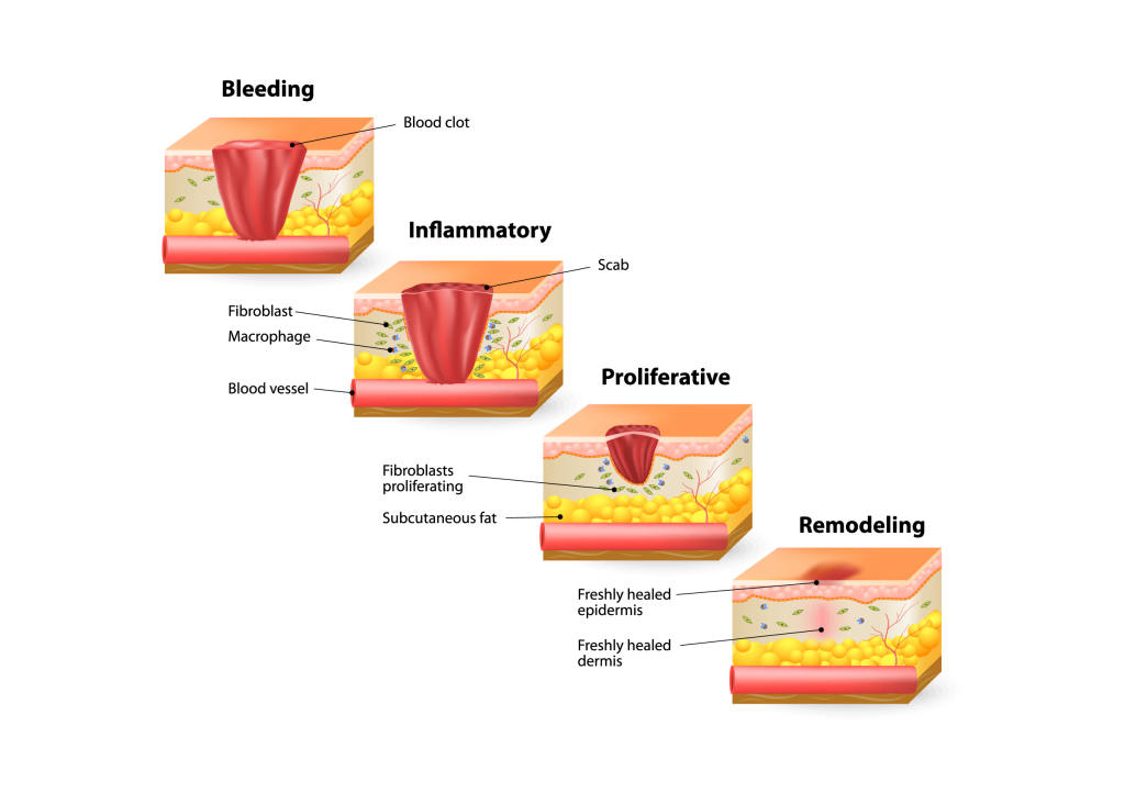 Wound Healing Process