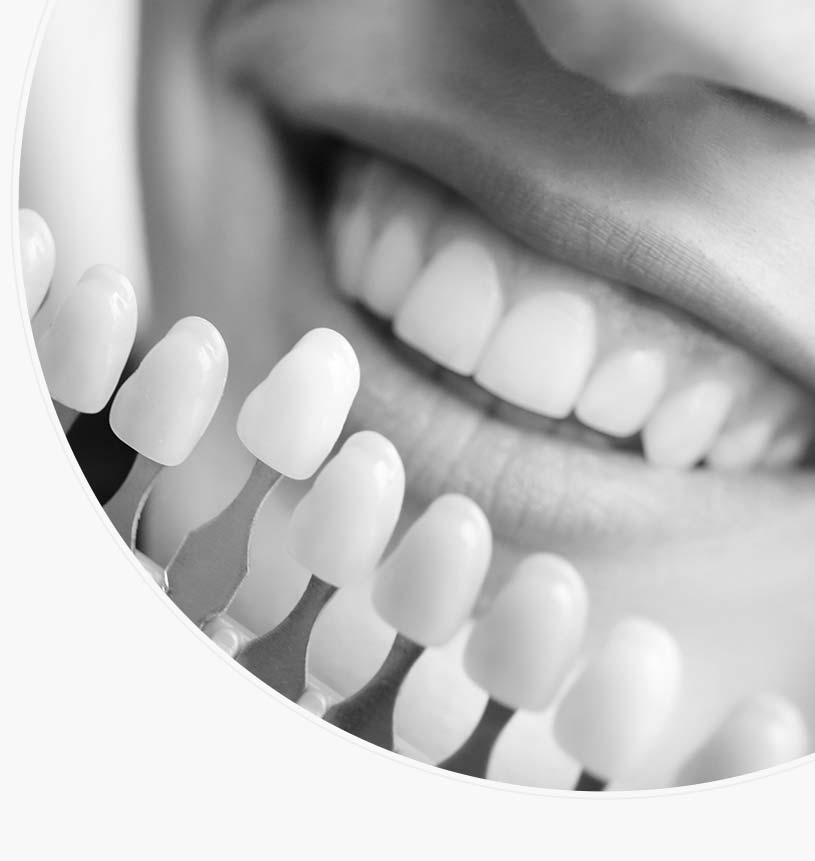Teeth Whitening Didsbury—Professional AtHome Whitening Kits with Fast Results—Teeth Bleaching
