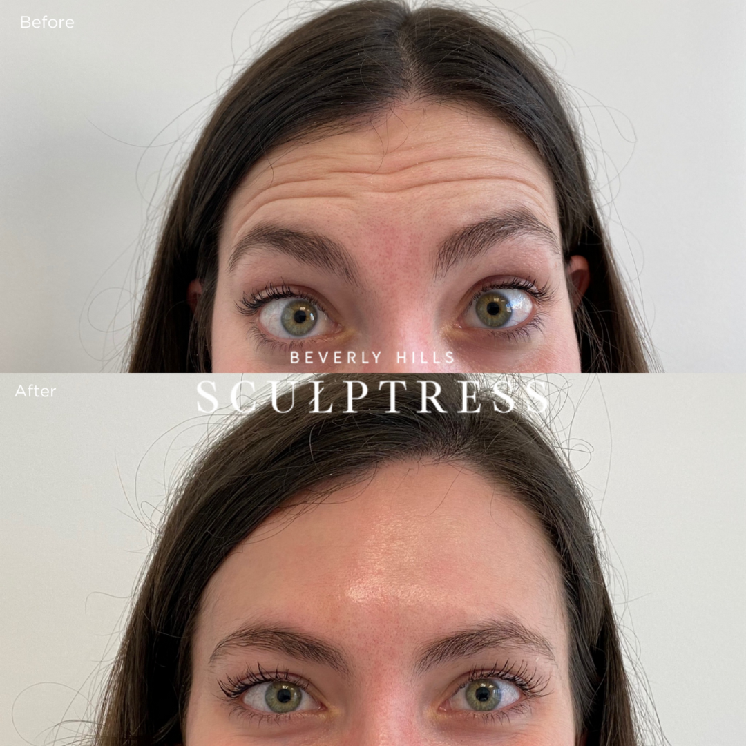 Cosmetic Skin Treatments Beverly Hills Scultpress Cosmetic Skin Treatments Beverly Hills Scultpress