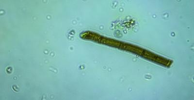 Soil Based Vs Spore Based Probiotics | GroveGypsy