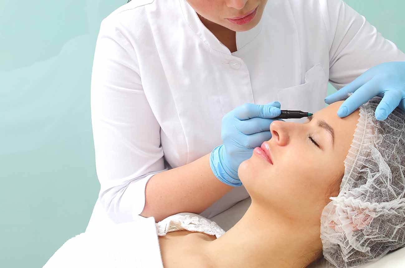 Brow Lift