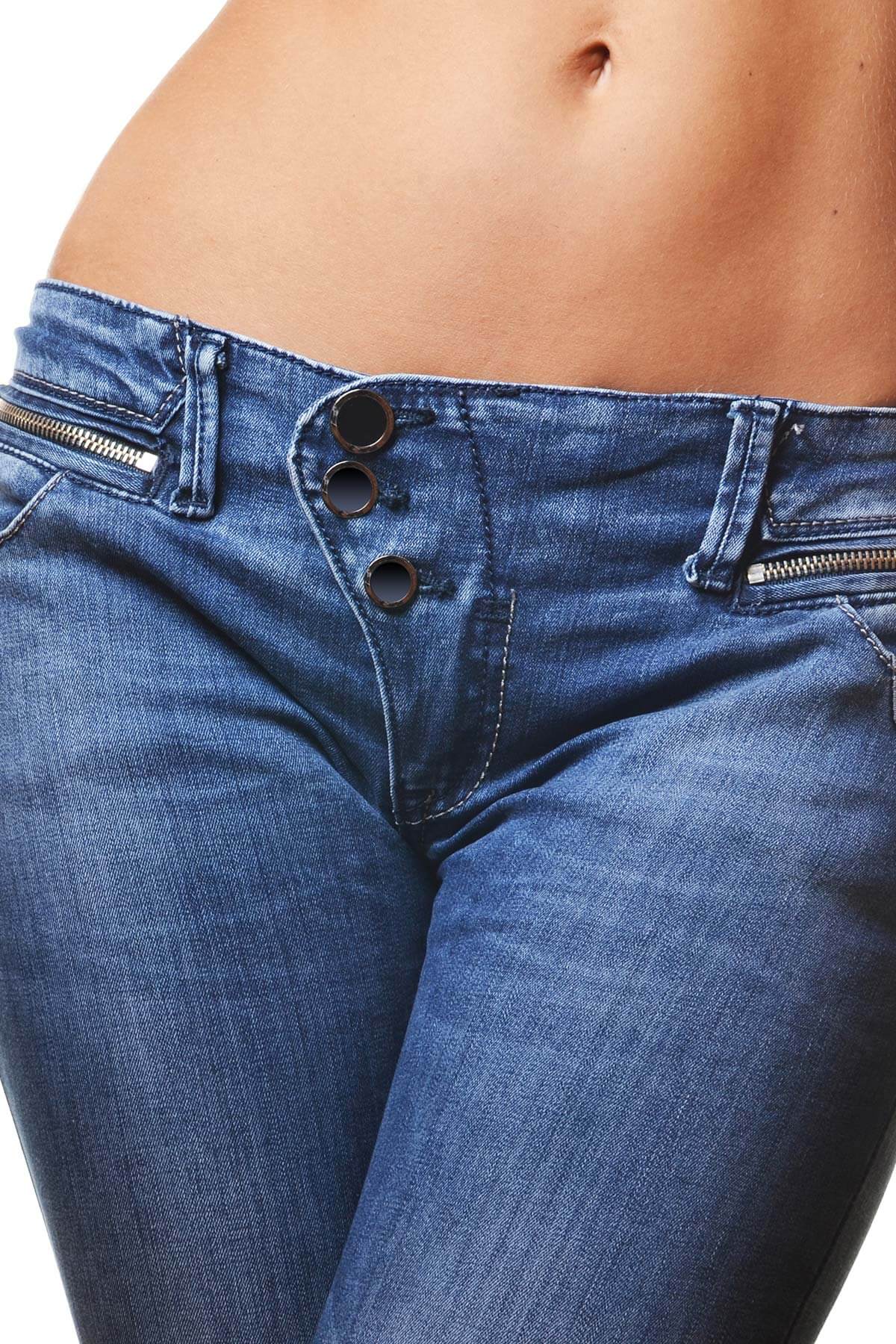Tummy Tuck Mississauga & Oakville