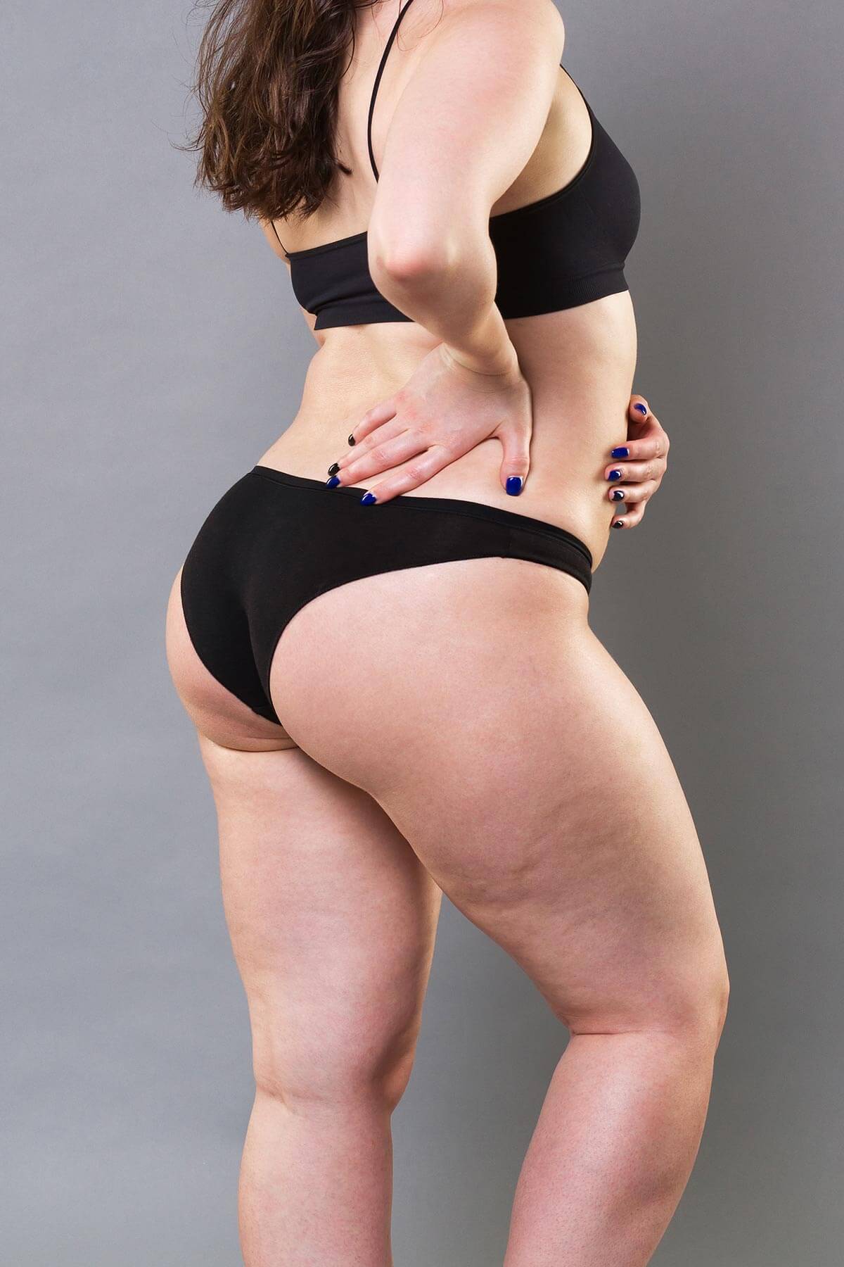 Thigh Lift Mississauga & Oakville