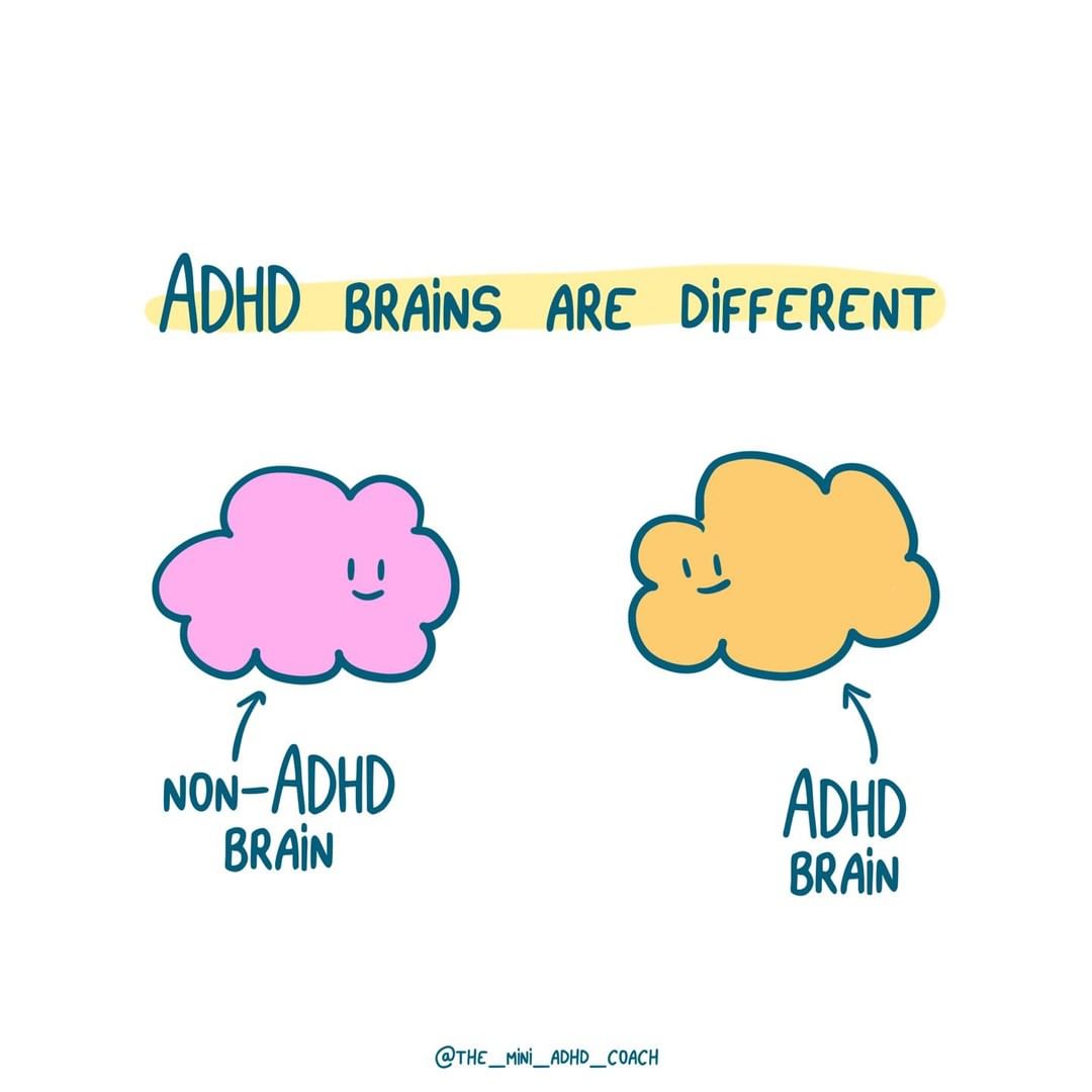 ADHD brains are different