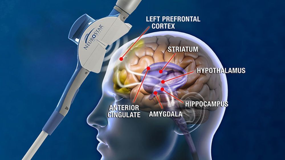 diagram of brain areas with NeuroStar tms device